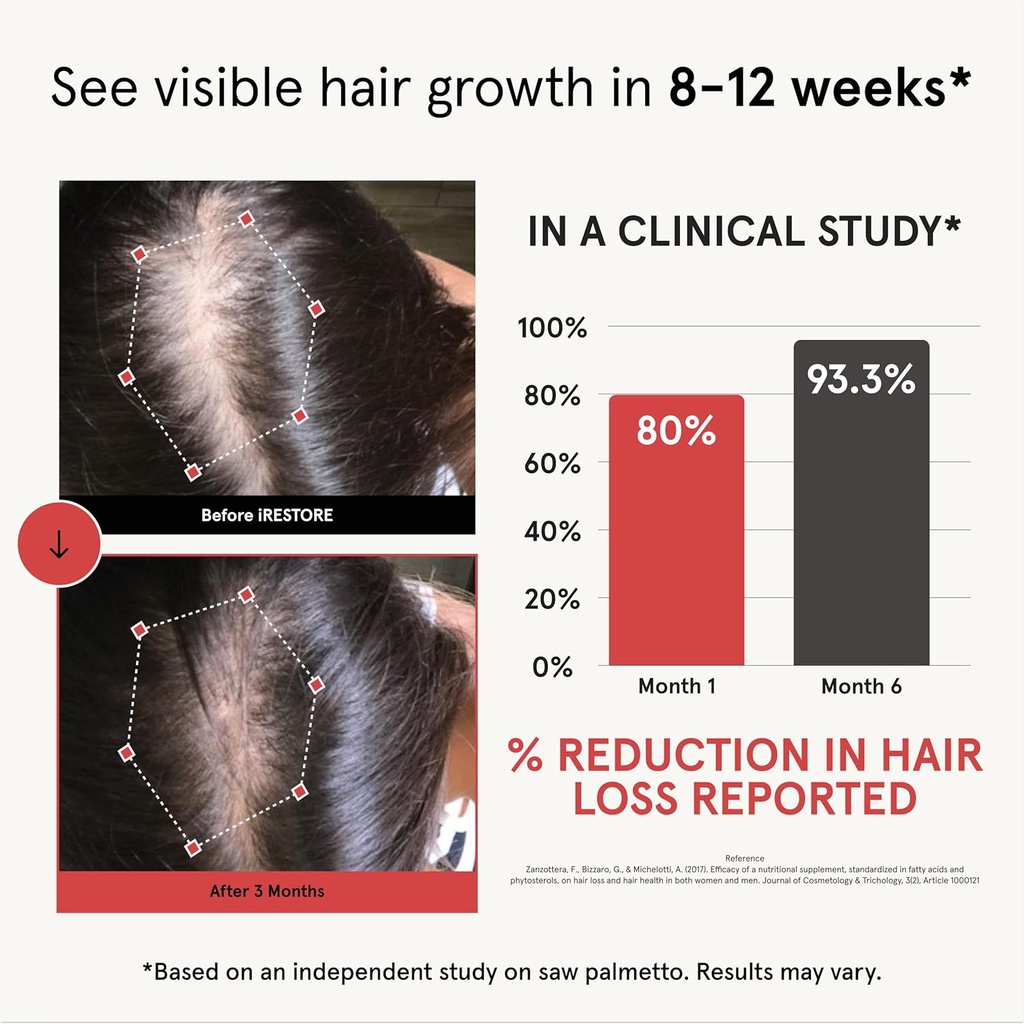 irestore-hair-growth-supplement-natural--2.jpg